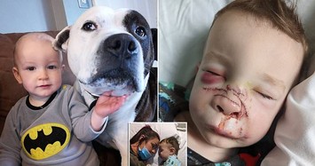 Nuôi chó cưng, bé trai 2 tuổi bị tấn công đau đớn