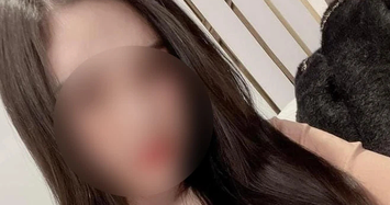 Cô gái sinh năm 2000 tử vong sau phẫu thuật nâng mũi ở Hà Nội 