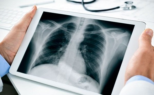 Bác sĩ nam bắt nữ bệnh nhân cởi hết quần áo chụp X-quang