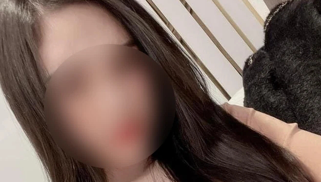Cô gái sinh năm 2000 tử vong sau phẫu thuật nâng mũi ở Hà Nội 