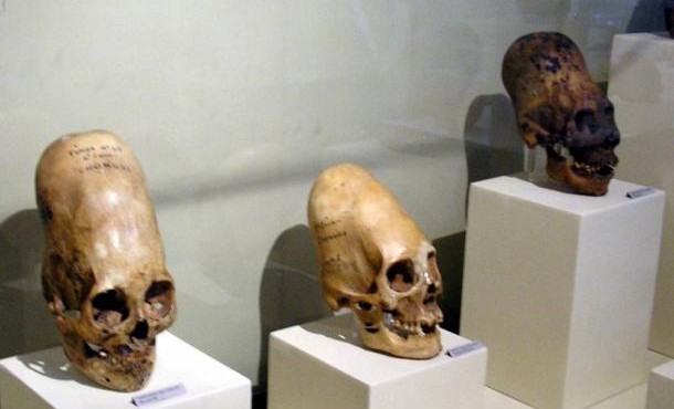 Bất ngờ những hộp sọ “dị hình” 3.000 năm tuổi
